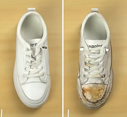 Before After 3